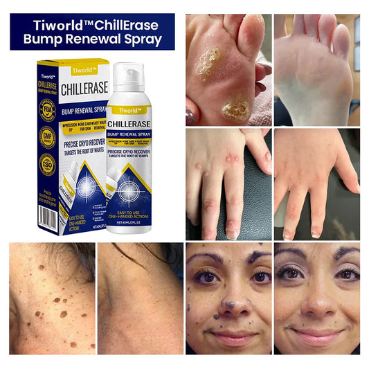 🎉Last Day Promotion 50% OFF - ChillErase Bump Renewal Spray