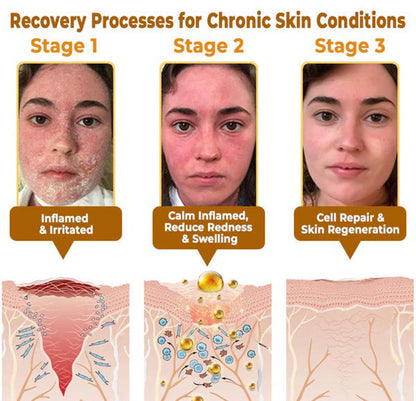 A natural discovery that can eliminate years of skin damage and end the daily struggle with psoriasis, wrinkles, and chronic skin conditions.