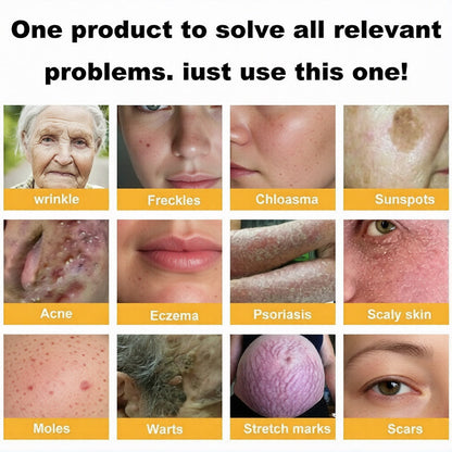 A natural discovery that can eliminate years of skin damage and end the daily struggle with psoriasis, wrinkles, and chronic skin conditions.