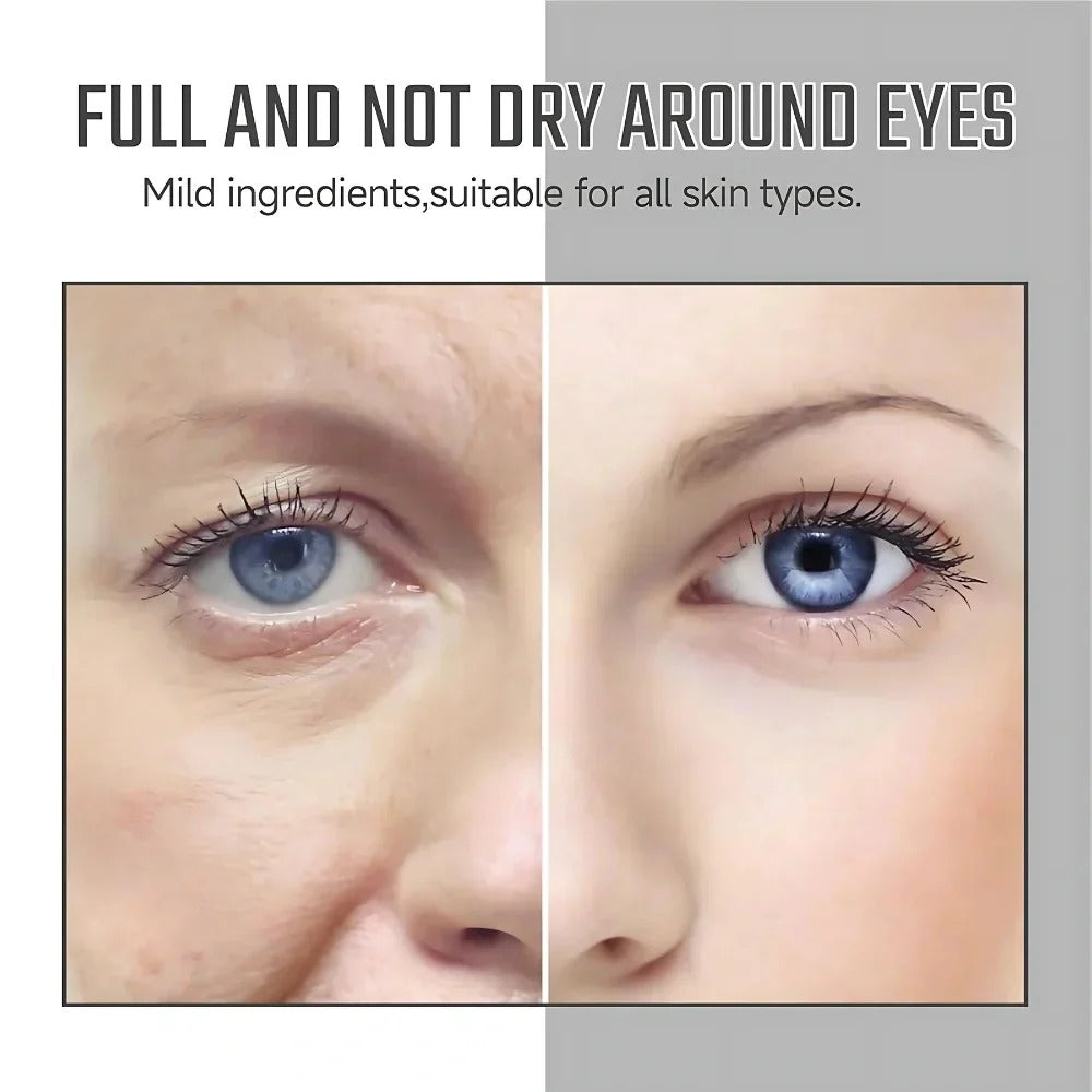 Lutein Anti-Wrinkle Serum – Firm & Radiant Skin | Buy 1 Get 1 Free 🎁
